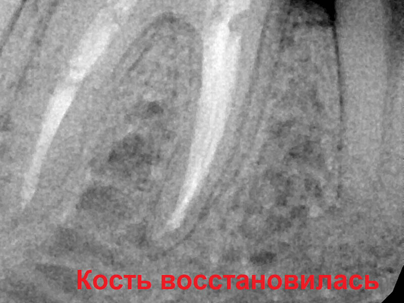 После лечения